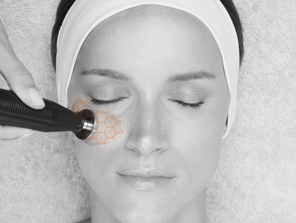 Treatment of model face